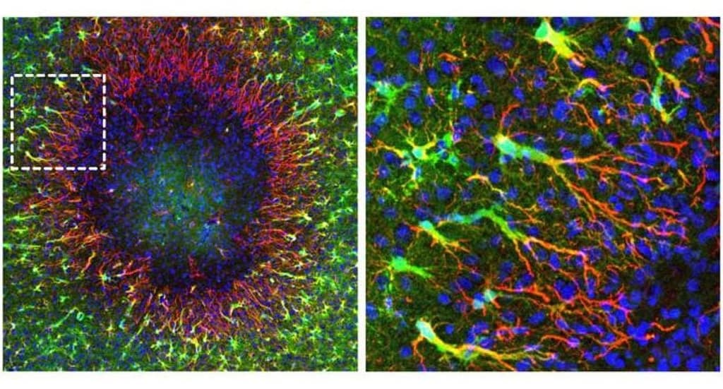 Regenerative Astrocytes Repair Brain Damage regenerative astrocytes repair brain damage