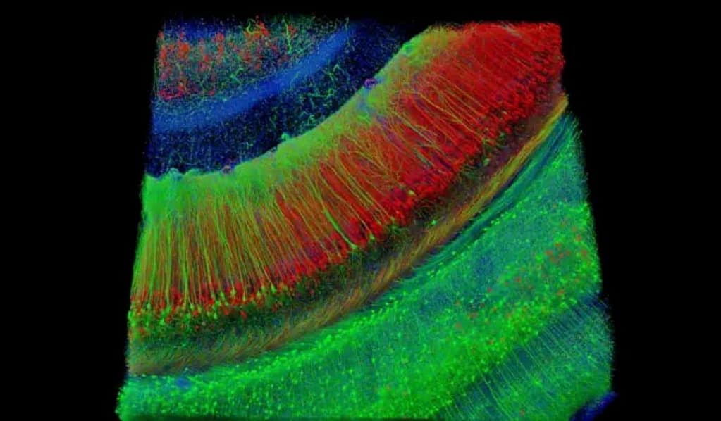 Virtual Hippocampus: Pinpointing Alzheimer’s “Tipping Points” virtual hippocampus: pinpointing alzheimer’s “tipping points”