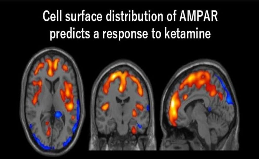 Ketamine Restores Plasticity via AMPA Receptors ketamine restores plasticity via ampa receptors