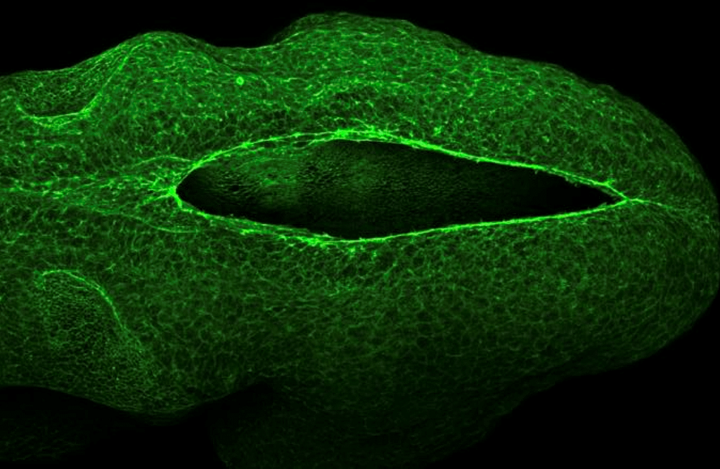 Cellular Drawstrings Seal the Developing Brain cellular drawstrings seal the developing brain