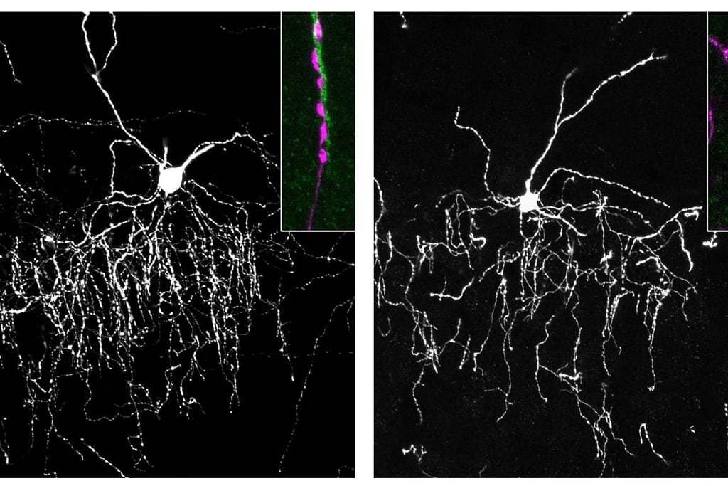 Brain Conductors Find Precise Connection to Target Cells via Protein Handshake brain conductors find precise connection to target cells via protein handshake