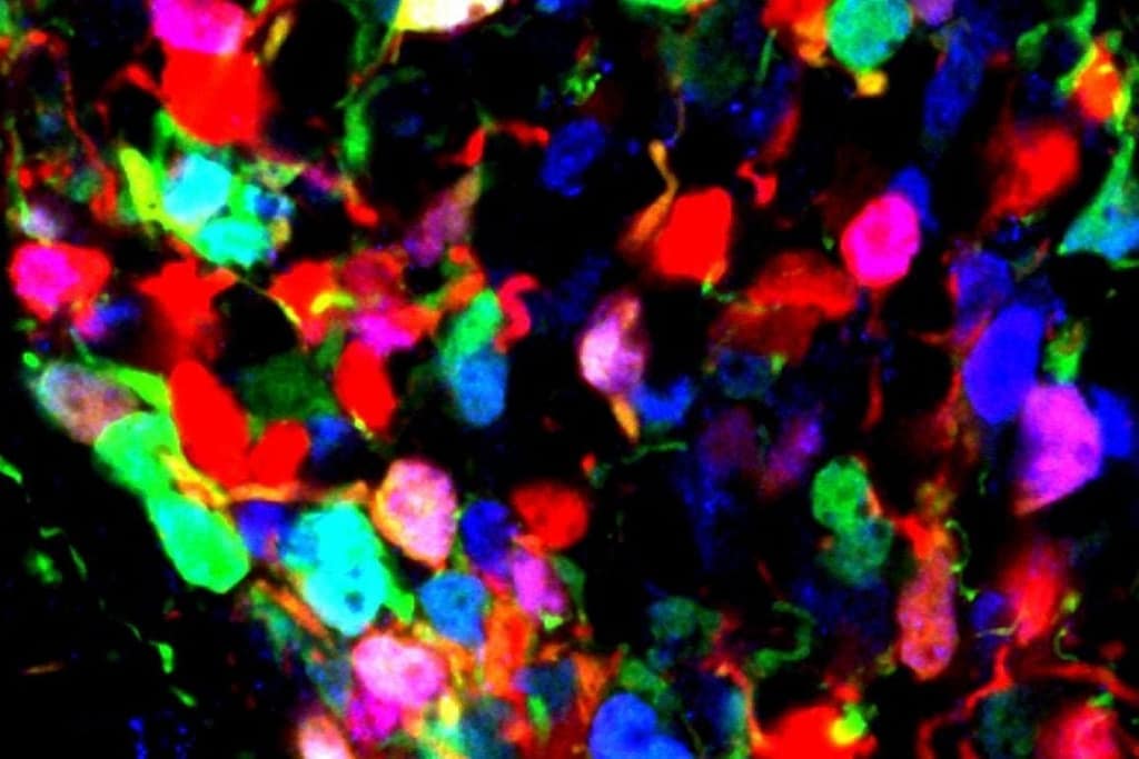 Brain’s Developmental Switch May Shape Lifelong Obesity Risk brain’s developmental switch may shape lifelong obesity risk