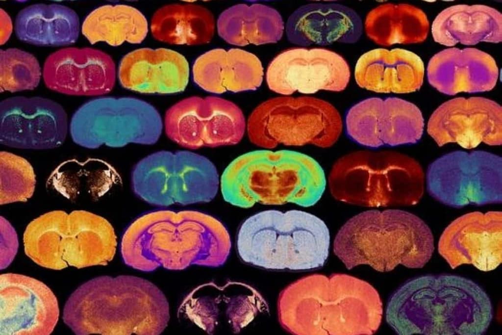 Glucose Levels Signal the Growth of Myelin glucose levels signal the growth of myelin