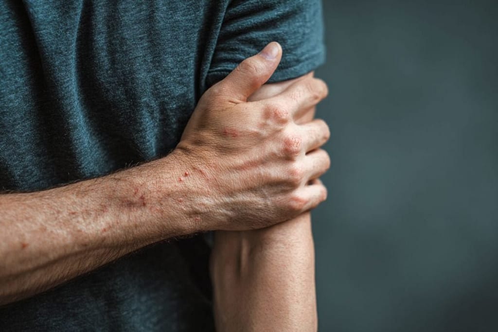 Touch Neurons That Drive Chronic Eczema Itch Revealed touch neurons that drive chronic eczema itch revealed