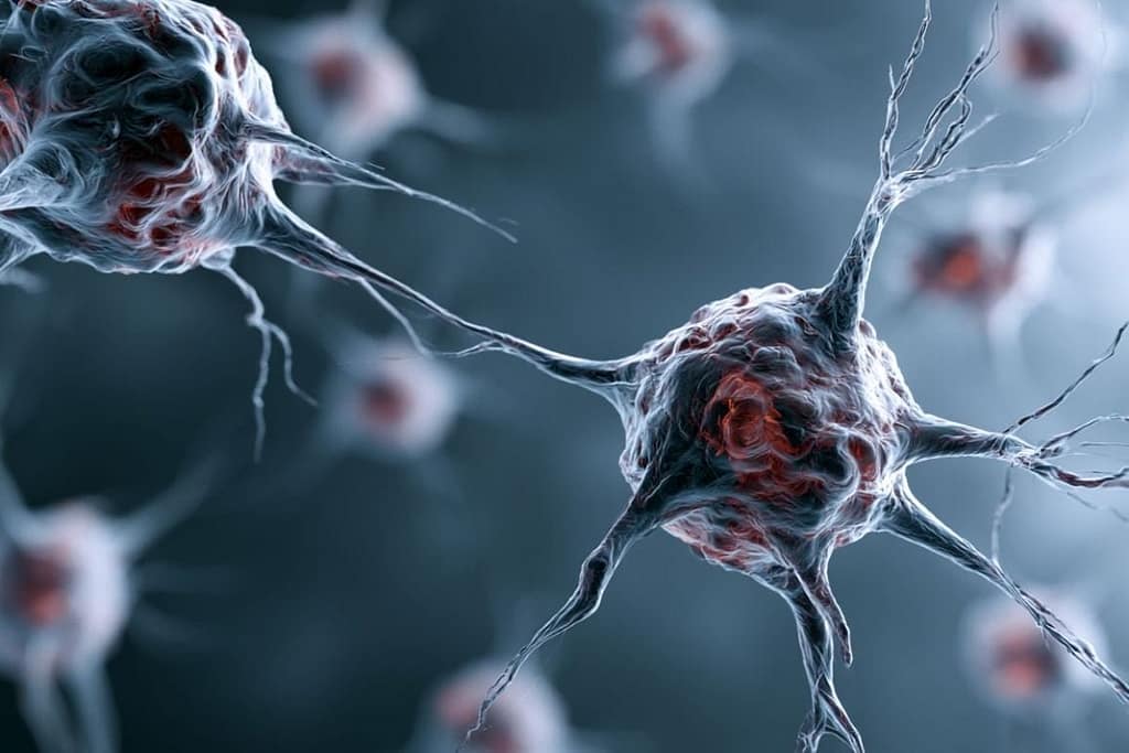 Viral Infection Found to Trigger Parkinson’s Brain Damage viral infection found to trigger parkinson’s brain damage