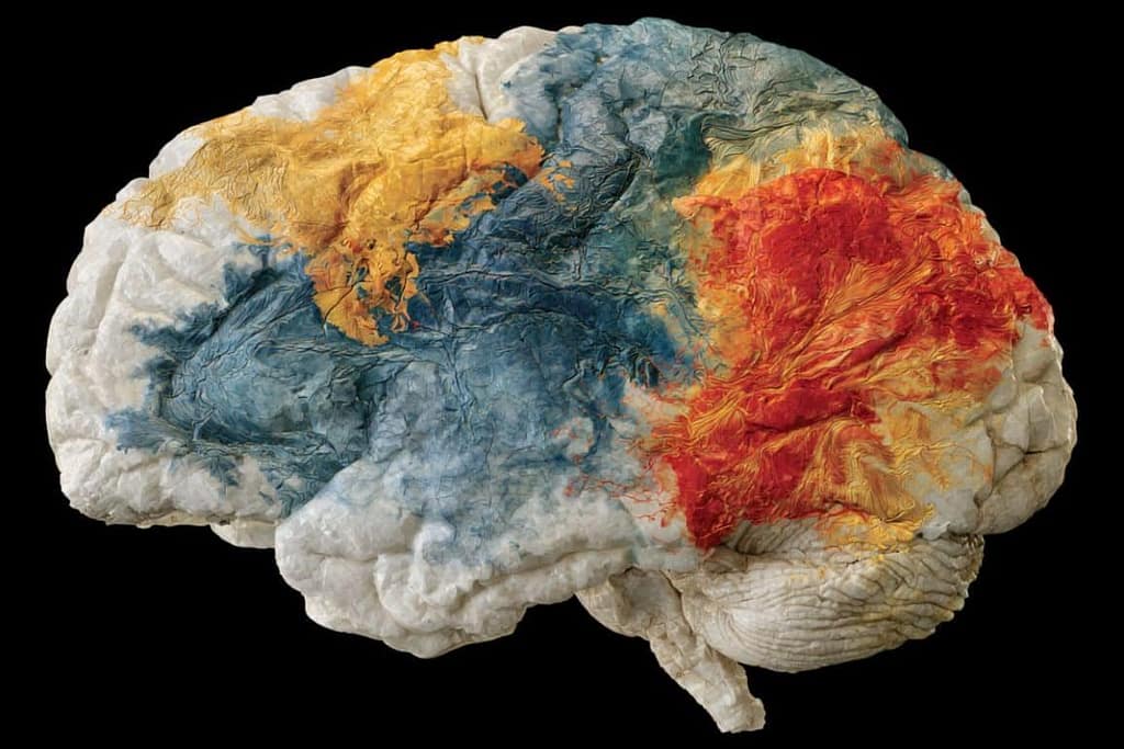 Study Maps Accelerated Brain Aging Signatures Across 9 Conditions study maps accelerated brain aging signatures across 9 conditions