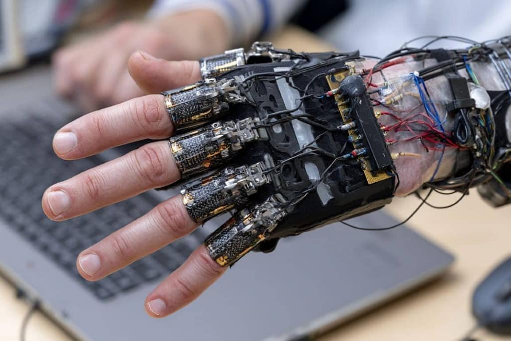 Exoskeleton Reads Faint Muscle Signals to Overcome Hand Paralysis exoskeleton reads faint muscle signals to overcome hand paralysis