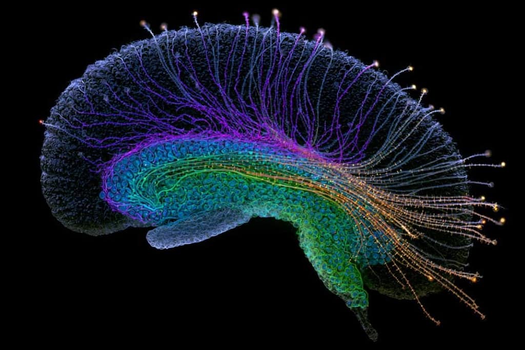 How Midlife Systems Remodeling Reshapes the Human Hippocampus how midlife systems remodeling reshapes the human hippocampus