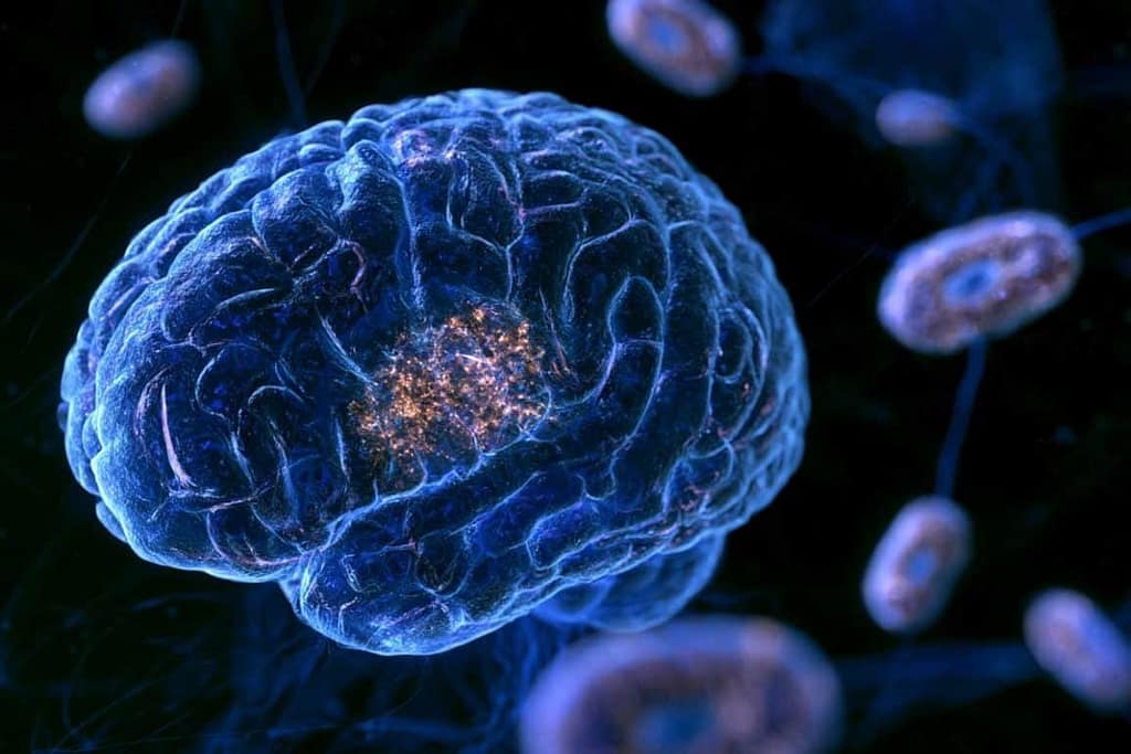 Mitochondrial Plaques in Alzheimer’s Brains Discovered mitochondrial plaques in alzheimer’s brains discovered