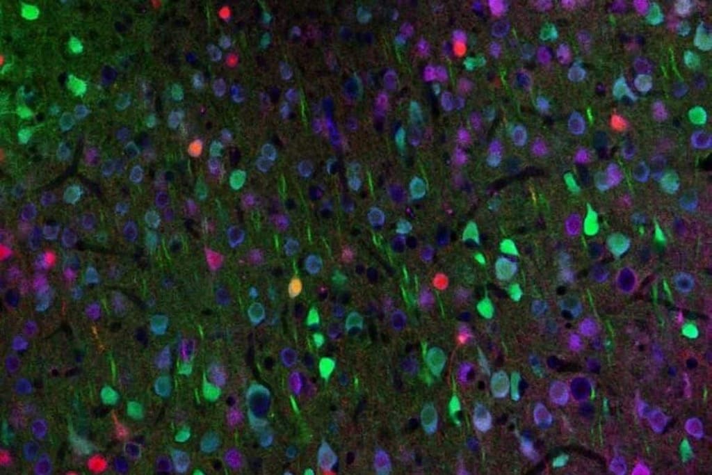 Optogenetics Restores Motor Learning in Huntington’s optogenetics restores motor learning in huntington’s