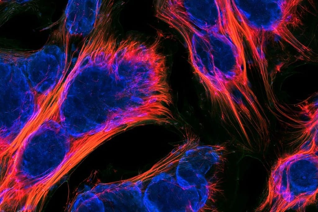 TRF2 Preserves Muscle Stem Cell Identity and Drive Repair trf2 preserves muscle stem cell identity and drive repair