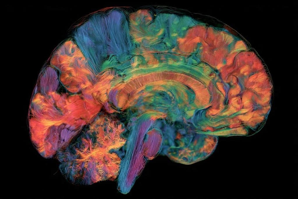 AI Maps Regional Brain Age and Alzheimer’s Risk ai maps regional brain age and alzheimer’s risk