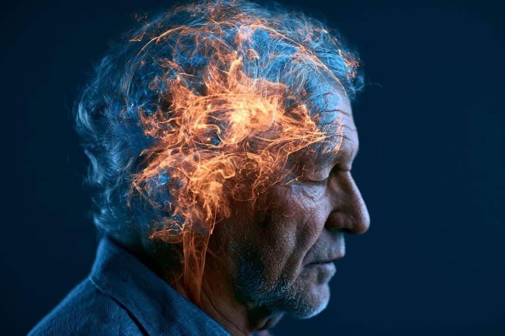 Midlife Vascular Health Adds Nearly 13 Dementia-Free Years midlife vascular health adds nearly 13 dementia free years